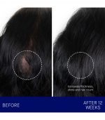 The Scalp Treatment - Image 3